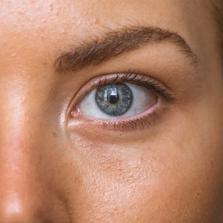 Hooded Eyes What are they? How to get rid of them