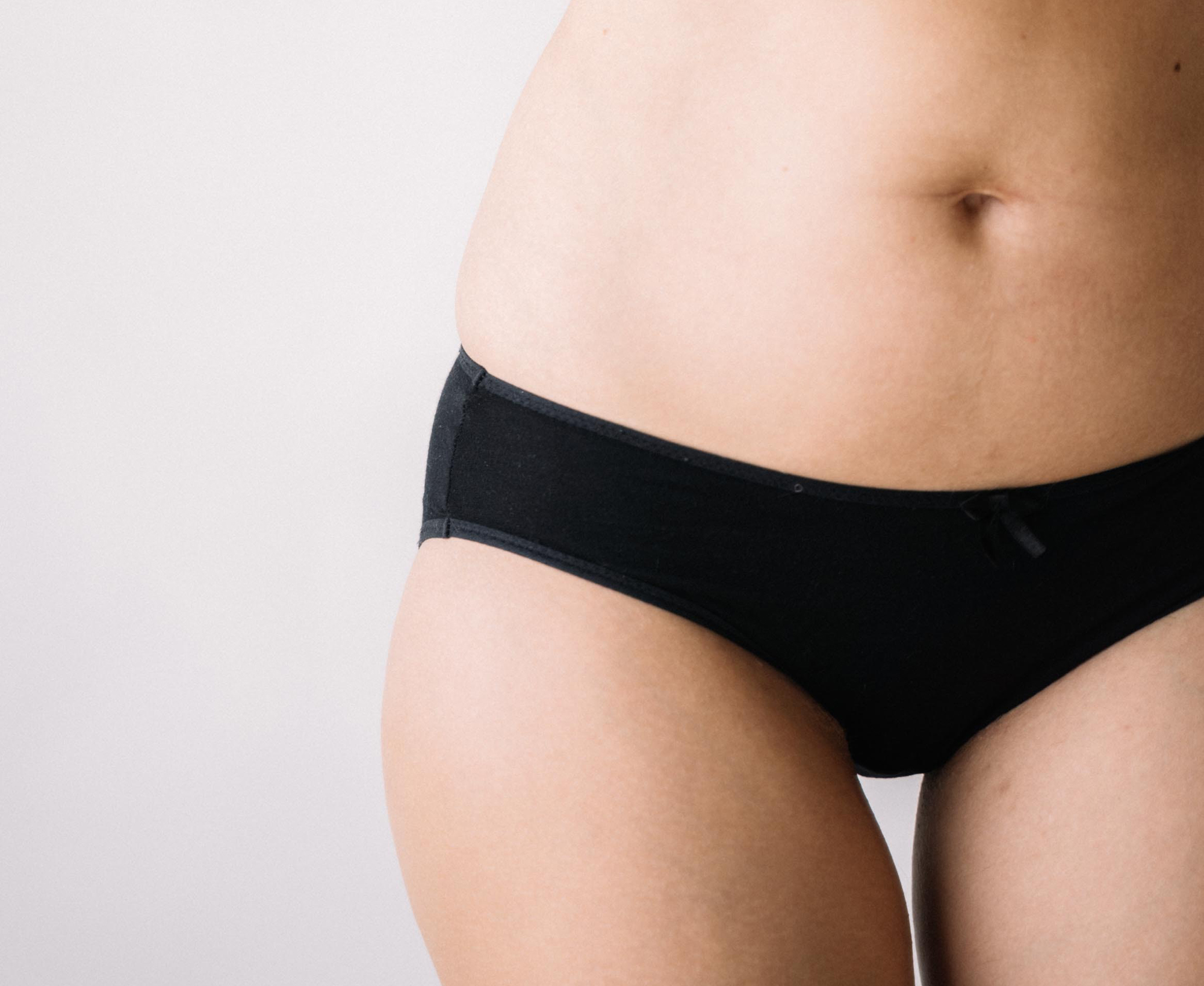 Do you have a Fatty Upper Pubic Area (FUPA)? CoolSculpting might