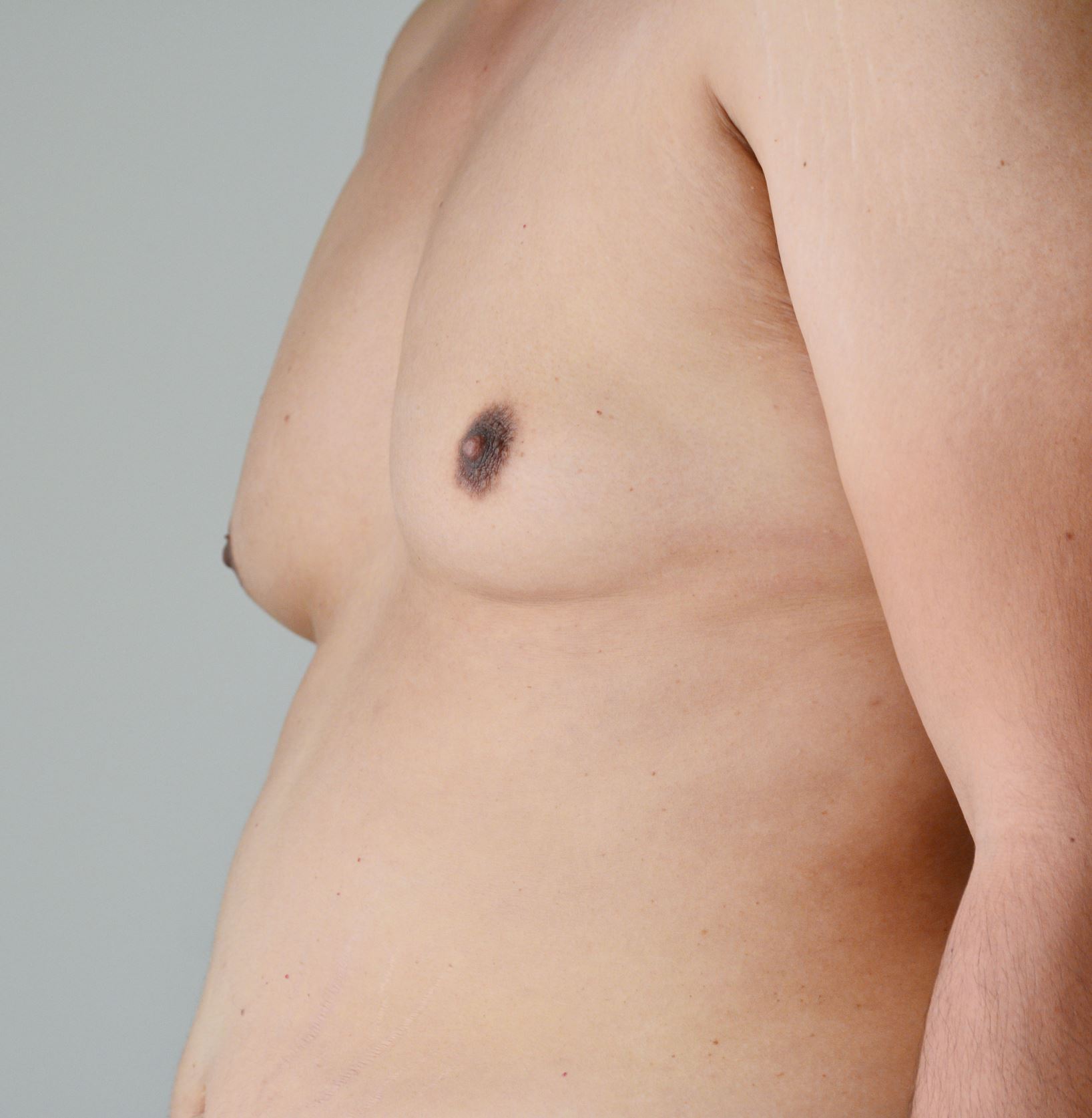 https://www.cadoganclinic.com/assets/images/hero/male_breast_reduction.jpg